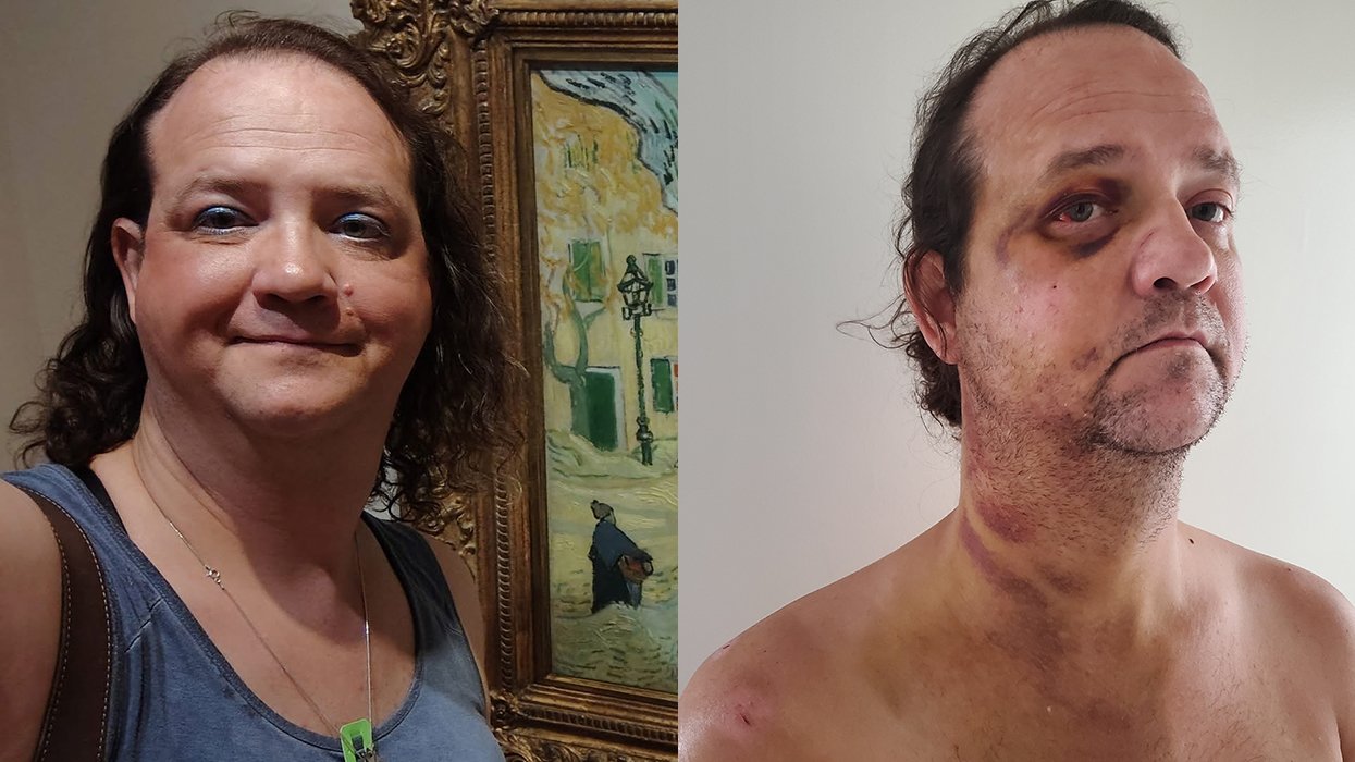 Transgender woman who escaped Alabama for her safety beaten &amp; left for dead near National Mall in D.C.