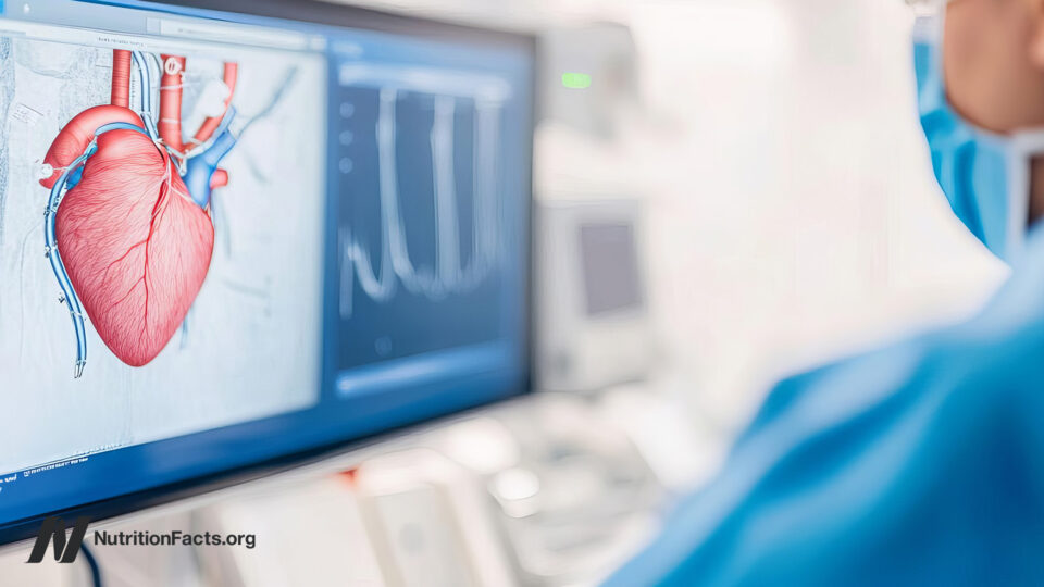 Gaming the System: Cardiologists, Heart Stents, and Upcoding 